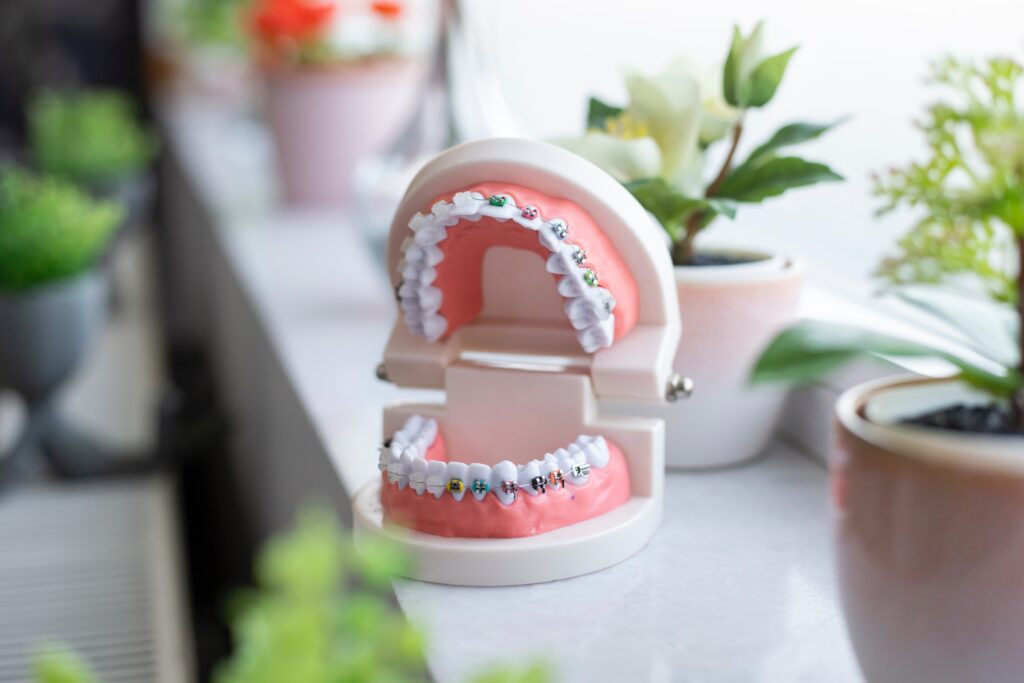 Europe’s leading orthodontics brand Impress appoints Hubble as UK media agency