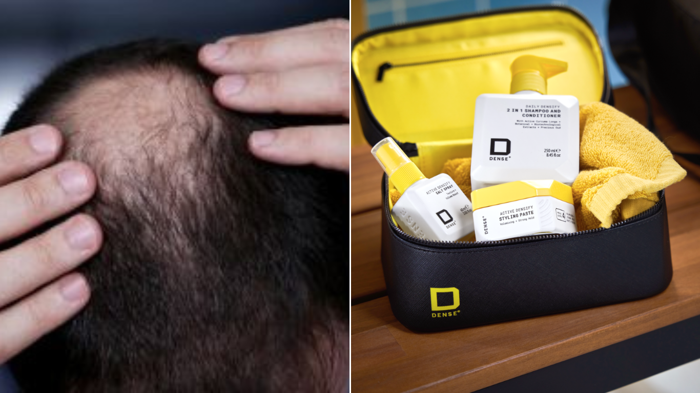 Bizarre things men are doing to hide hair insecurities during the