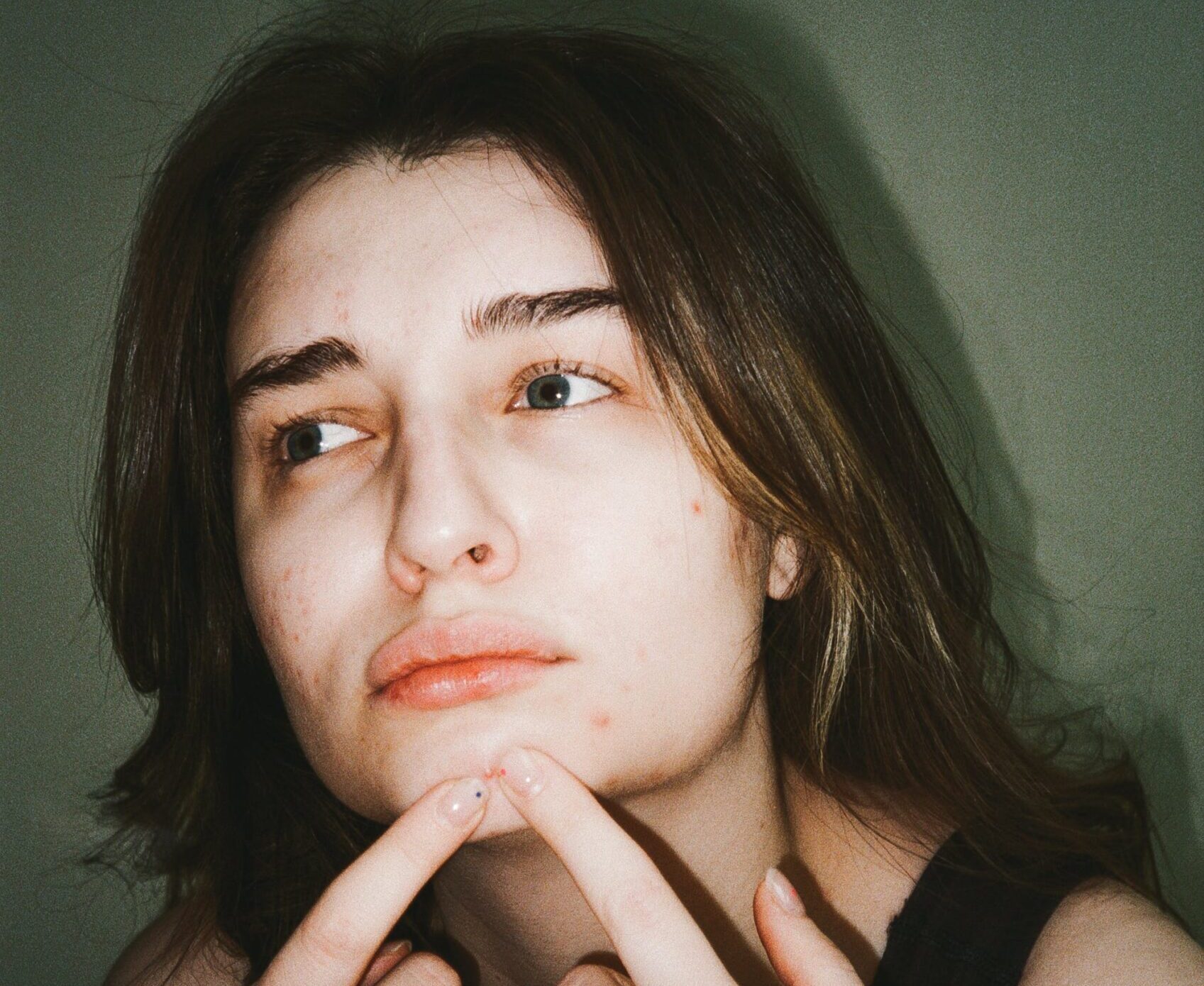 4 causes of perimenopausal acne and how to tackle them London Daily News