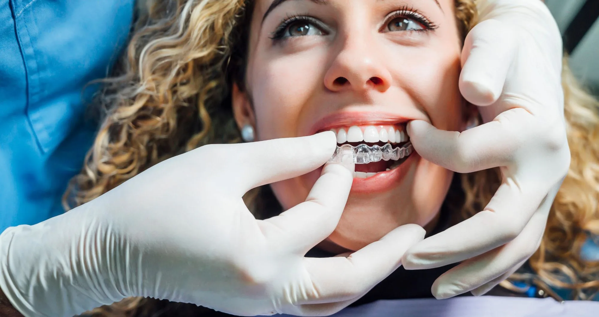 Invisalign i7