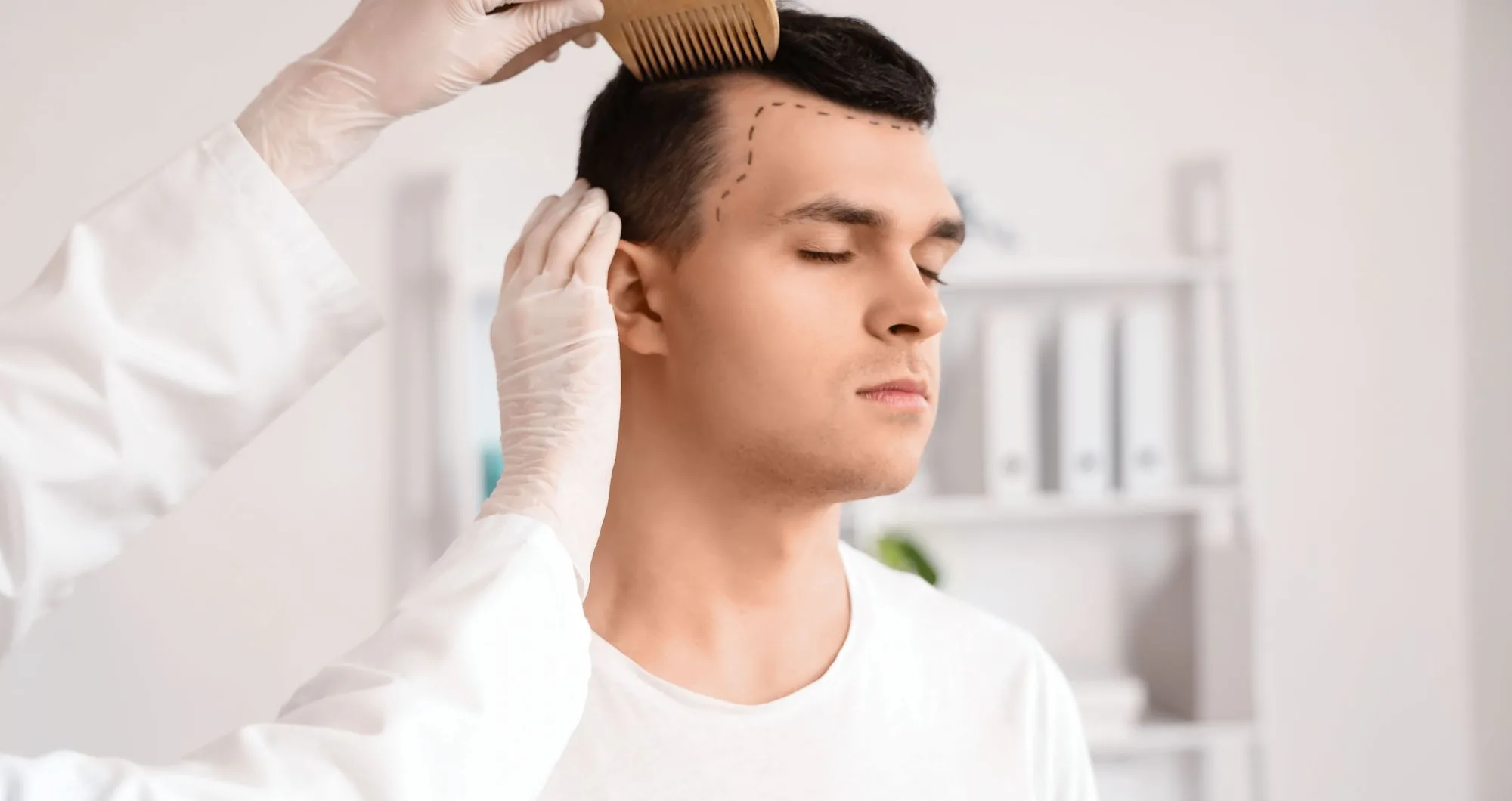 Restore your hairline with hair transplant grafts