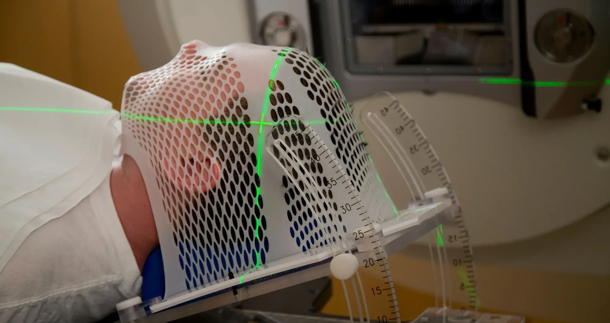 Charity calls for better GP access to brain scans after report reveals barriers to uptake