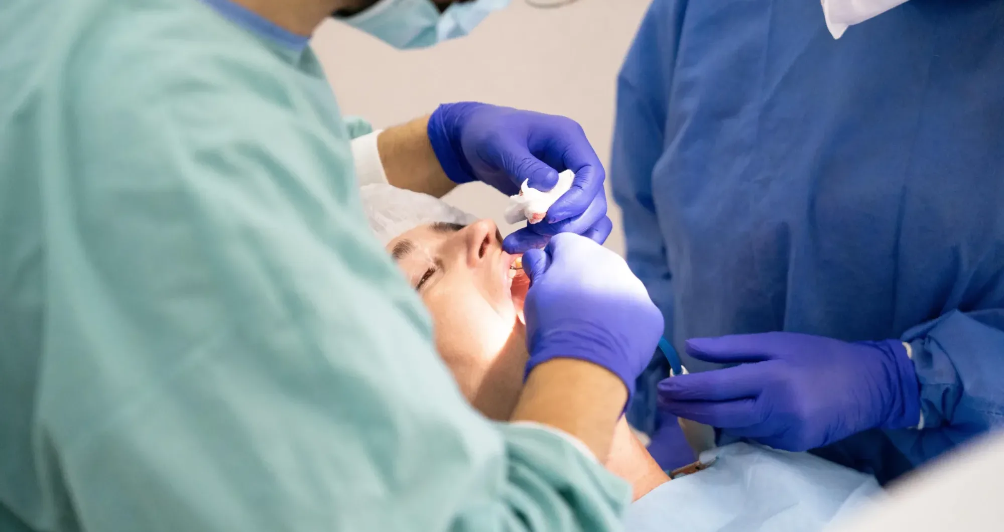 Benefits of choosing full mouth dental implants today