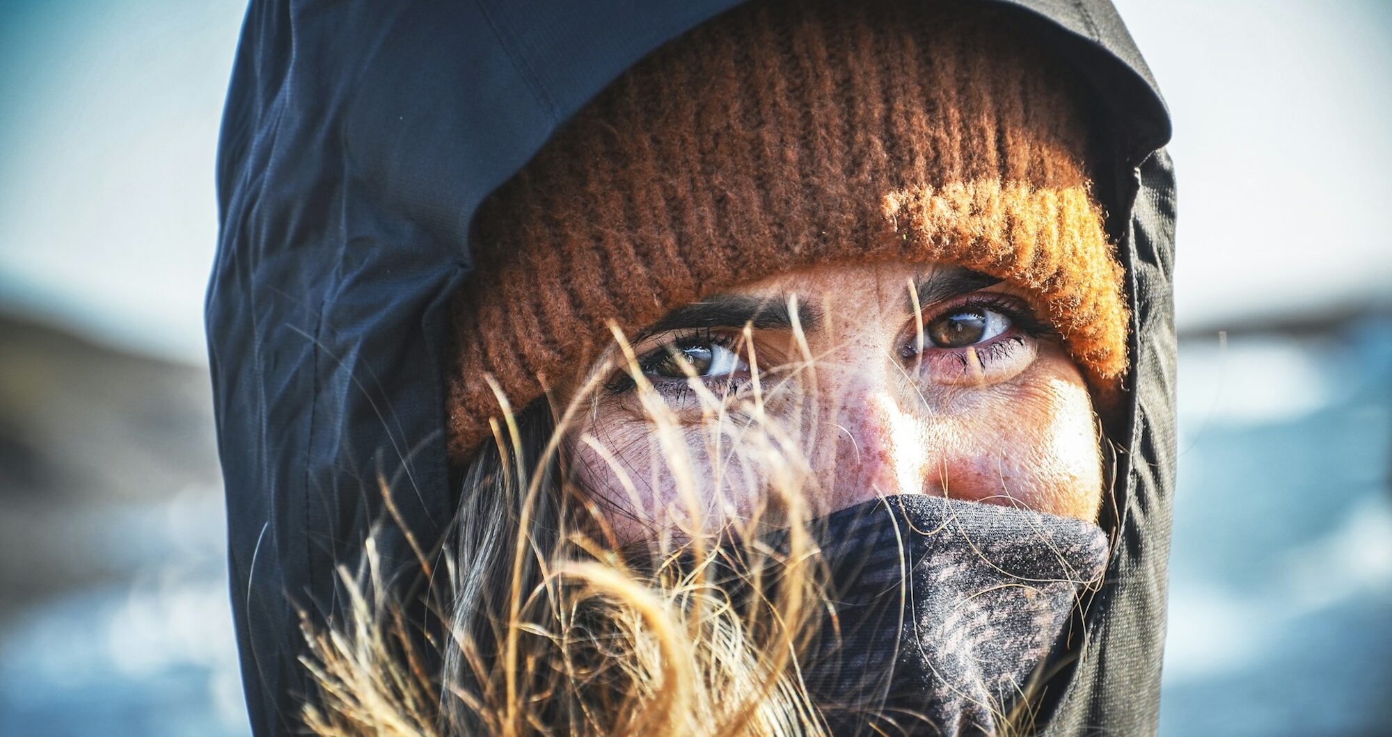 Cold weather, hot showers, and Christmas stress: Hidden triggers behind psoriasis flare-ups