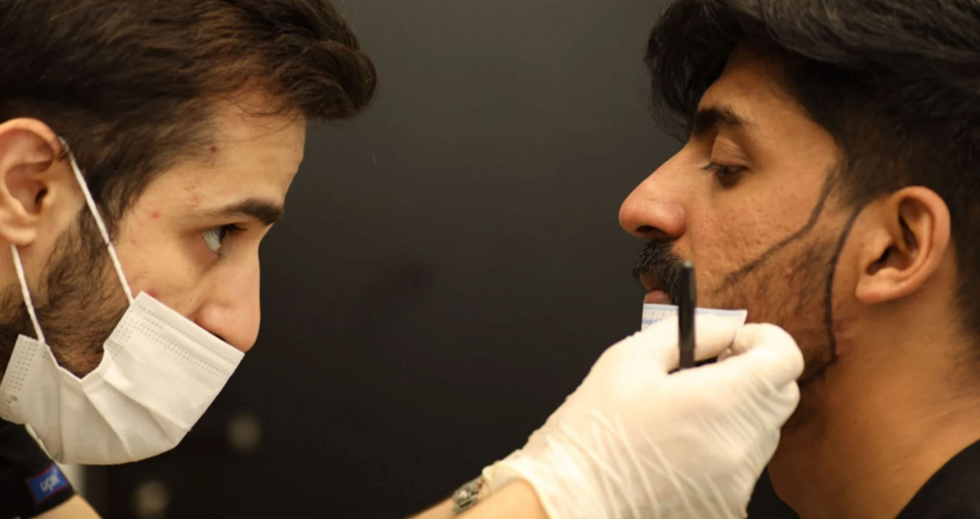 Beard transplants are booming- 6 things hair surgeons want you to know before booking