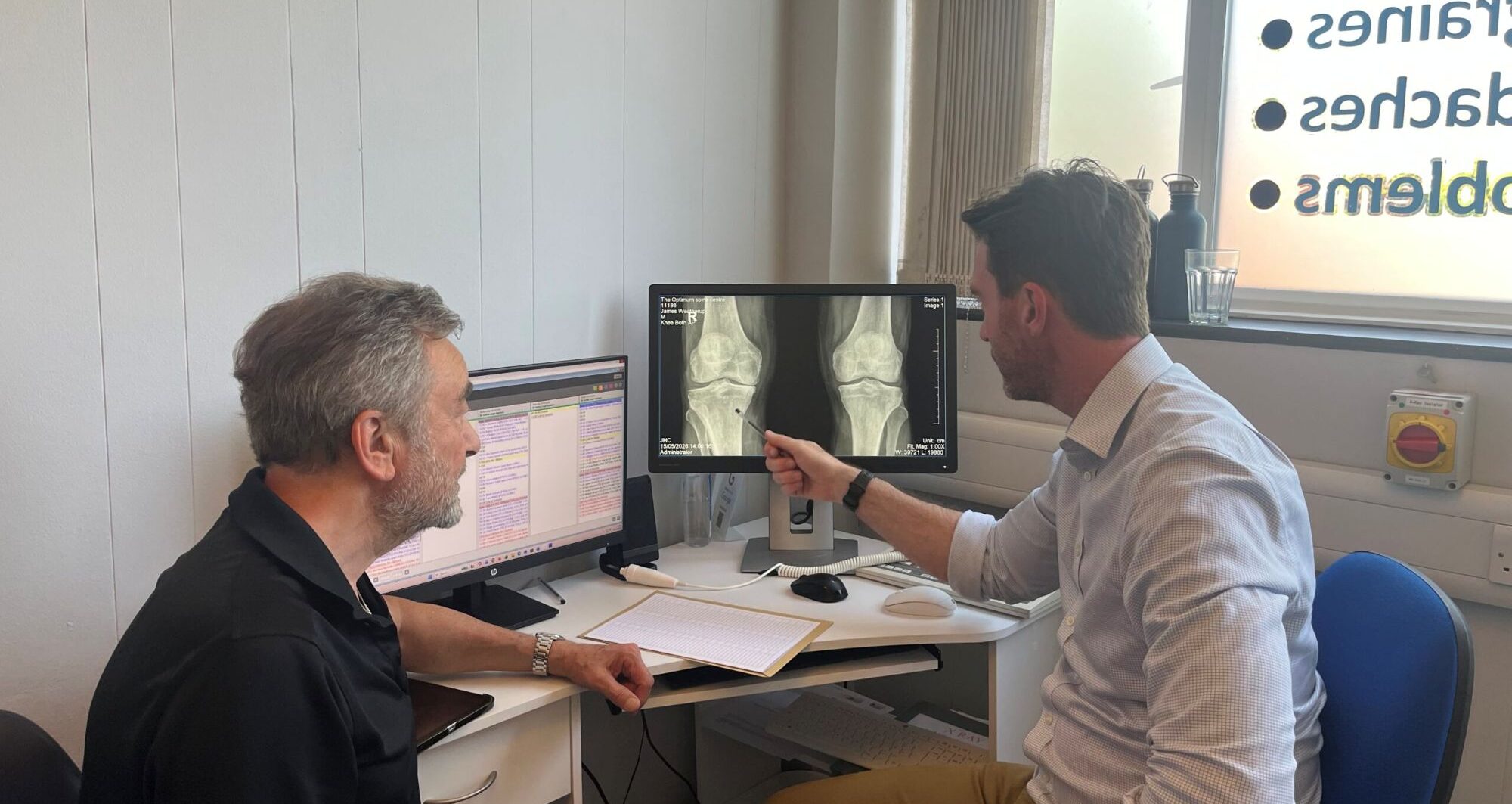 Could Arthrosamid help delay knee replacement surgery?