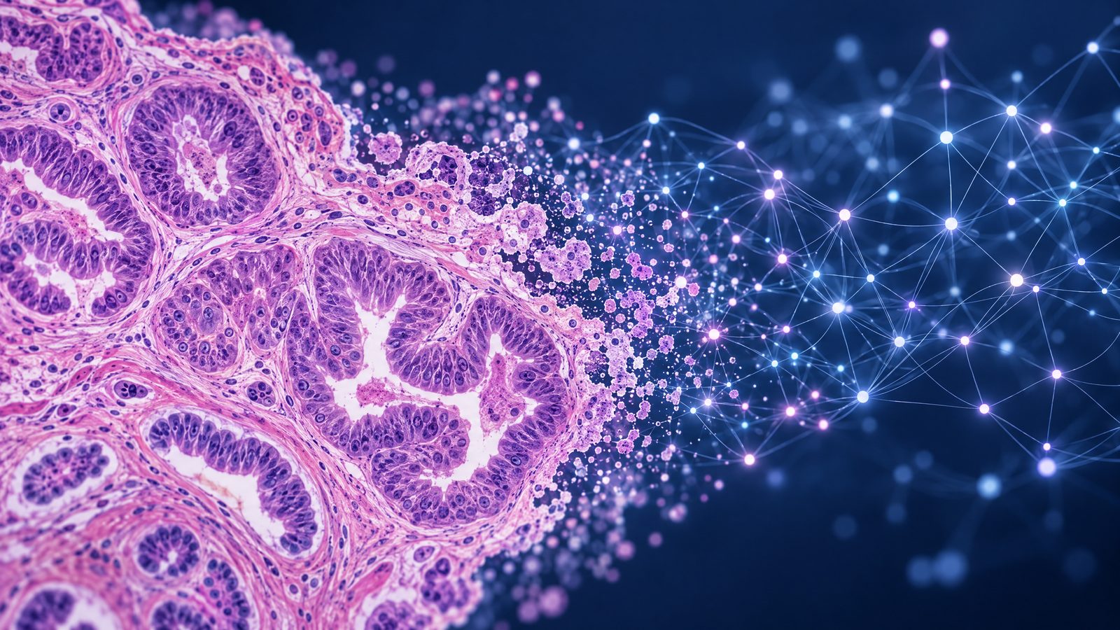 AI model reads ovarian cancer tissue images for DNA-repair clues